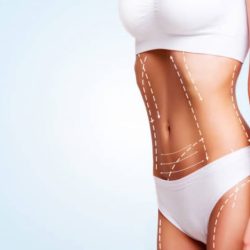 Tipos-de-liposucción-y-lipoescultura-cuál-es-la-mejor-opción-1024×682 (1)