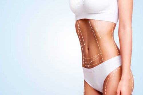 Consejos postoperatorios de una Lipoescultura
